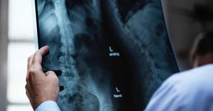 Medical images and details of 24.3 million patients left exposed on the internet